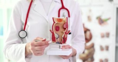 Doktor kalemle insan rektumunun hastalıkları açıklayan gerçekçi modelini gösteriyor. Tıbbi üniforma uzmanı vücut anatomisini ağır çekimde gösteriyor.