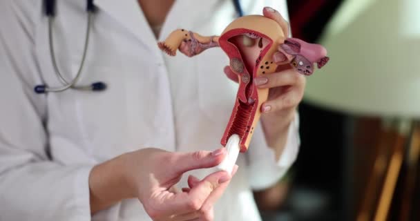 Kvinnlig Läkare Sätter Tampong Vaginal Öppning Realistisk Livmoder Modell Specialist — Stockvideo