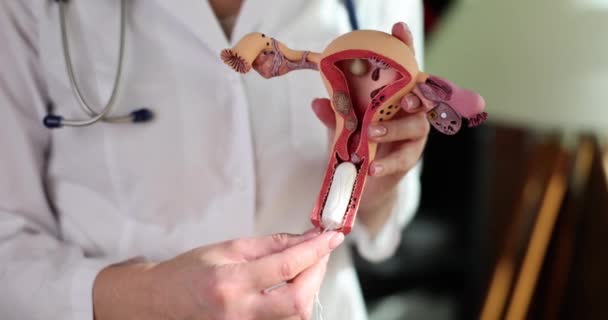 Higiénikus Tamponok Méhben Nőgyógyász Kezében Nőgyógyászati Tampon Használati Szabályok — Stock videók