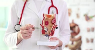 Doktor rektumun anatomik modelini tutuyor, yakın plan. Proktolog muayenesi, hemoroit.