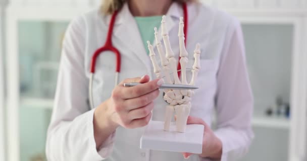 Fisiologista Mostra Esqueleto Mão Clínica Dor Óssea Devida Cancro — Vídeo de Stock