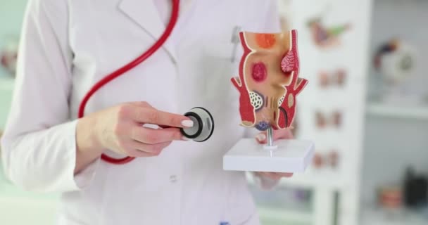 直肠与痔疮的解剖学模型 医生用听诊器进行测试 与血栓形成和炎症有关的痔疮 — 图库视频影像