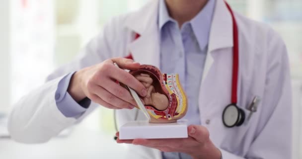 Gynekolog Sätter Foster Livmodern Pekar Penna Till Detaljer Läkaren Visar — Stockvideo
