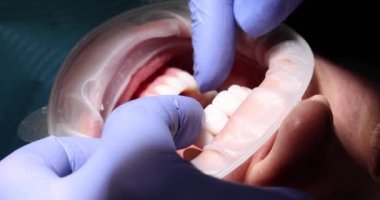 Lastik eldivenli dişçi, kanepede ağzı açık yatan kadın hastaya dokunuyor. Doktor kadını yavaş çekimde prosedüre hazırlıyor.