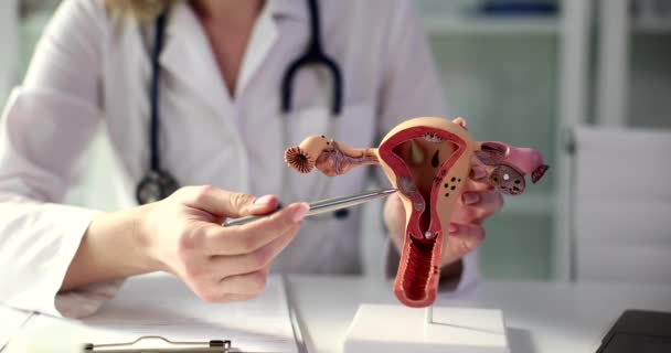 Jinekolog Doktor Kalemle Rahmin Yumurtalıkların Modelini Gösteriyor Kadın Üreme Organlarının — Stok video