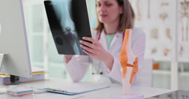 Врач Осматривает Рентген Коленного Сустава Клинике Разрыв Мениска Вызывает Симптомы — стоковое видео