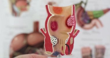 Doktor eli rektumun yapay modelini tutuyor ve insan organlı posterlere karşı patolojiler taşıyor. Vücut anatomisi ve hastalıkları kavramı kısmen ağır çekim