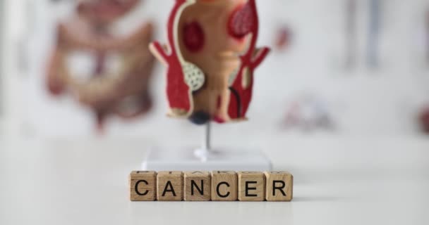Word Cancer Aus Holzwürfeln Gegen Verschwommenes Mastdarmmodell Auf Weißem Tisch — Stockvideo