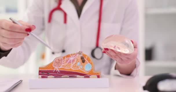 Médico Aponta Caneta Para Modelo Artificial Mama Segurando Implante Silicone — Vídeo de Stock