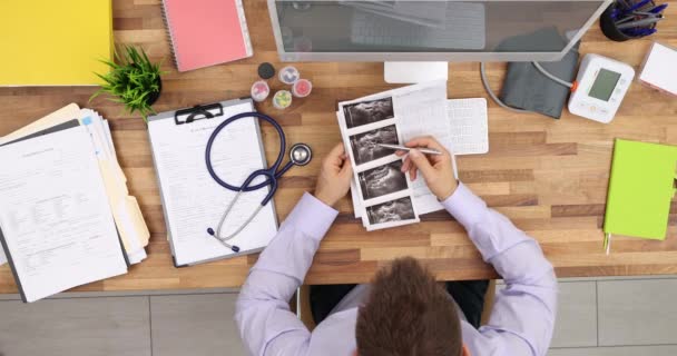 Doktor Bilgisayarın Yanındaki Ahşap Masada Oturan Hastanın Ultrason Fotoğraflarını Inceliyor — Stok video