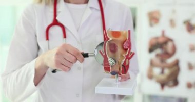 Proktolog elinde büyüteç ve hemoroitli rektumun anatomik modelini tutuyor. Hemoroitler akut semptomlar ve tedavi