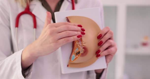 Ženský Lékař Ukazuje Vysvětluje Onemocnění Pomocí Anatomického Modelu Prsu Mléčné — Stock video