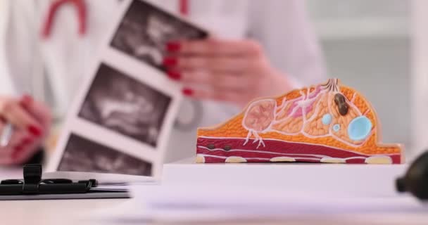 Dokter Mammoloog Onderzoekt Het Resultaat Van Mammogram Borsttest Met Röntgenscan — Stockvideo