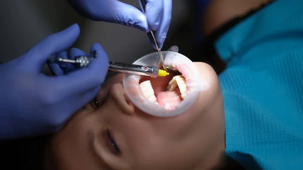 Dentist injecting anesthetic into patient gum for painless dental treatment closeup. Pharmaceuticals in dentistry concept