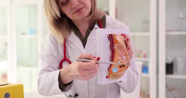 女医生在诊所办公室解释女性疾病 专家展示了受影响女性胸部的结构 将笔尖指向桌子慢动作 — 图库视频影像