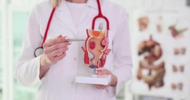 Doktor, iltihaplı vasküler yapıları olan sağlıksız alt rektum modelini tutuyor. Hemoroit problemi