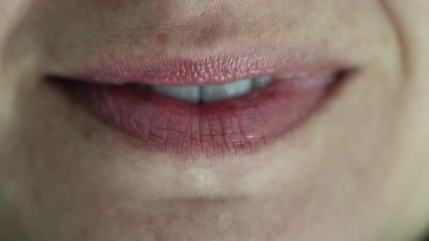 Labbra Rosse Bel Sorriso Bianco Come Neve Installazione Impiallacciatura Sorriso — Video Stock