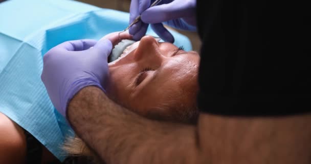 牙科手术病人的牙印 牙科医生试用牙龈样本作牙龈检验 — 图库视频影像