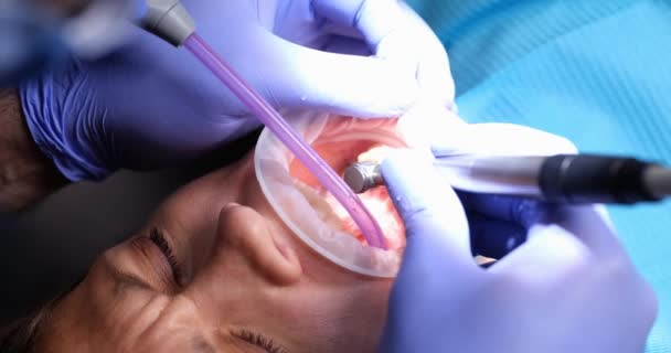 Γυναίκα Οδοντίατρος Αντιμετωπίζει Δόντια Του Νεαρού Ασθενή Κορίτσι Στην Οδοντιατρική — Αρχείο Βίντεο