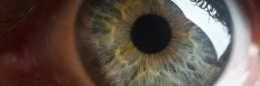 Women wide open gray green pupil closeup. Astigmatism farsightedness myopia and laser vision correction