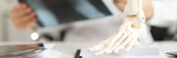 stock image Doctor holds x-ray of foot and anatomy of bones of leg. Diagnosis and treatment of arthritis concept