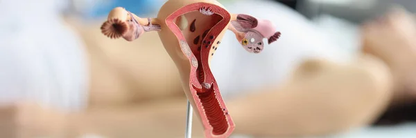 Reception Gynecologist Office Ultrasound Female Uterus Women Health Concept Anatomy — Foto de Stock