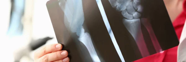Γιατρός Κρατώντας Ακτινογραφία Χεριών Στην Κλινική Τραυματολογία Καρπού Ακτίνων Και — Φωτογραφία Αρχείου