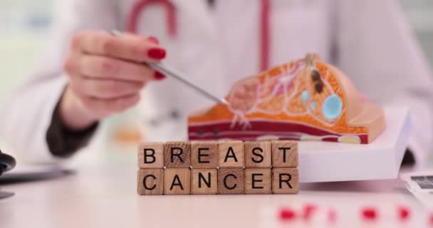Meme Kanseri Modelinin Anatomik Belirtileri Mamolog Doktorun Ellerinde Göğüs Kanseri — Stok video