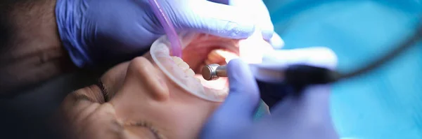 Tandläkare Behandla Tänder Med Maskin Och Verktyg Närbild Tandvårdskoncept — Stockfoto