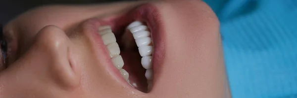 Patient Mit Offenem Mund Und Veneers Unterkiefer Beim Zahnarztbesuch Nahaufnahme — Stockfoto