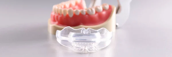 Σιλικόνη Ορθοδοντικά Δοχεία Για Κρατήσει Δόντια Και Τεχνητή Γνάθο Ορθοδοντική — Φωτογραφία Αρχείου
