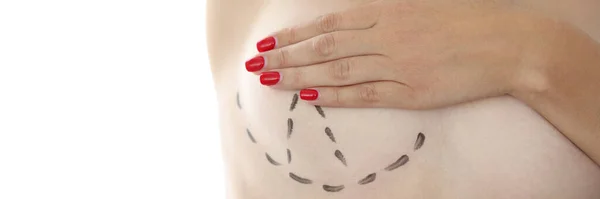 Correction Lift Breast Augmentation Plastic Surgery Preparation Mammoplasty Concept — Stock Photo, Image