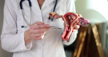 Doctor gynecologist demonstrates model of female reproductive system. Gynecological care and uterus anatomy