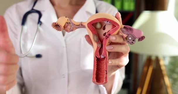 Nőgyógyász Anatómiai Modell Női Nemi Szerv Mutatja Hüvelykujj Fel Nőgyógyászati — Stock videók