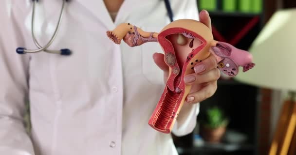 Les Mains Gynécologue Médecin Tiennent Modèle Utérus Tampon Gros Plan — Video