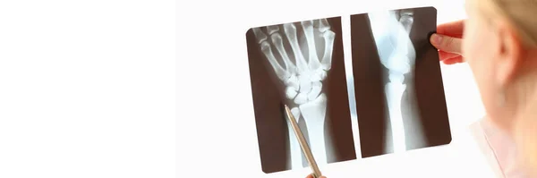 Γιατρός Εξετάζει Την Ακτινογραφία Των Χεριών Πόνος Στα Χέρια Αιτίες — Φωτογραφία Αρχείου