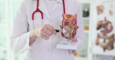 The doctor holds a magnifier and anatomical model of the anus. Search for hemorrhoids, conceptual medicine