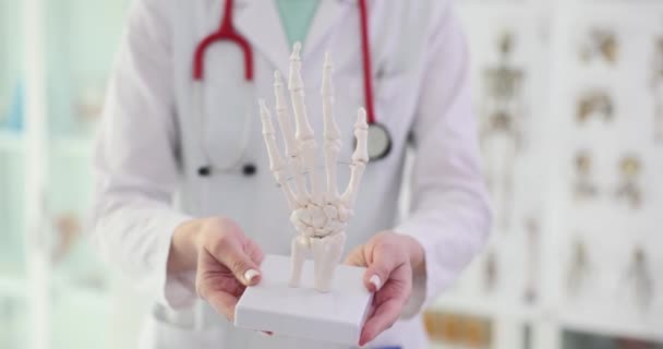 Médico Sostiene Parte Del Esqueleto Mano Humana Cerca Fractura Ósea — Vídeo de stock