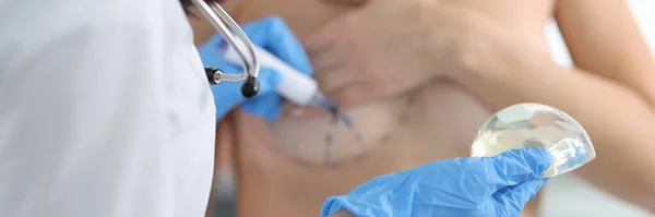 医師は女性の乳房美容整形手術にマークを描きます シリコーンインプラントと胸リフトのコンセプト — ストック写真