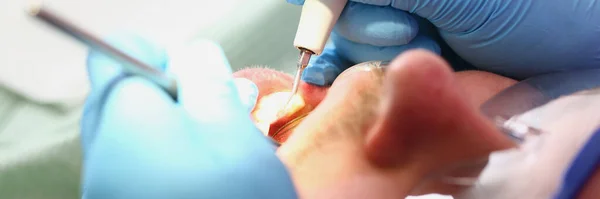 Zahnarzt Untersucht Mundhöhle Des Männlichen Patienten Mit Spiegel Dienstleistungen Von — Stockfoto