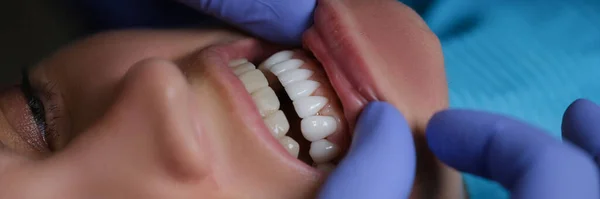 Zahnarzt Der Zähne Mit Veneers Weiblicher Patientinnen Klinischer Nahaufnahme Untersucht — Stockfoto