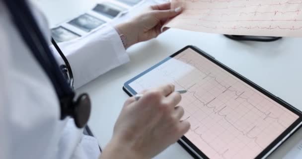 Kardiyolog Hastanın Elektrokardiyogramını Yakından Inceler Kardiyovasküler Sistem Hastalıkları Önleme Kavramı — Stok video