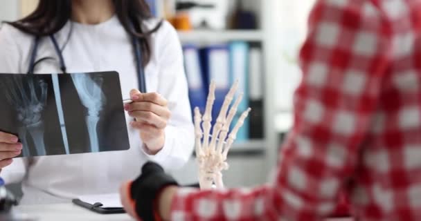 Der Chirurg Betrachtet Das Röntgenbild Des Handgelenks Sorgfältig Und Stellt — Stockvideo