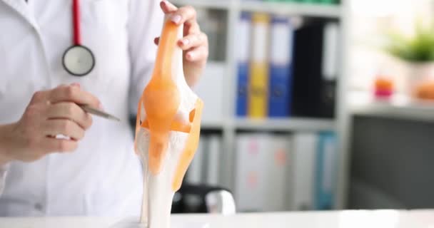 Γιατρός Δείχνει Μοντέλο Ανθρώπινης Τεχνητής Άρθρωσης Γόνατος Στο Ιατρικό Γραφείο — Αρχείο Βίντεο