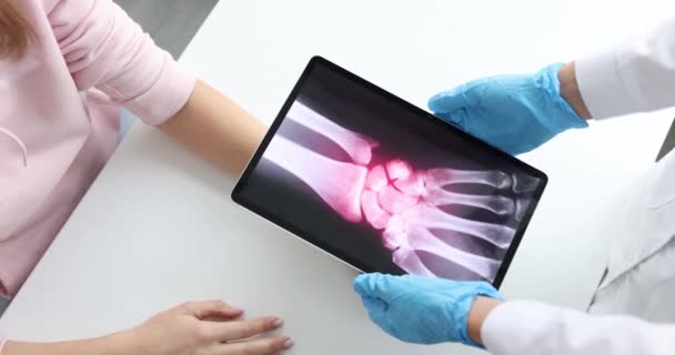 Doctor traumatologist holding digital tablet with xray near patient hand closeup 4k movie slow motion. Fracture diagnosis and treatment concept