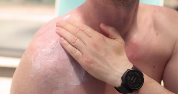 Hombre Poniendo Protector Solar Película Cuerpo Rojo Protección Piel Frente — Vídeos de Stock
