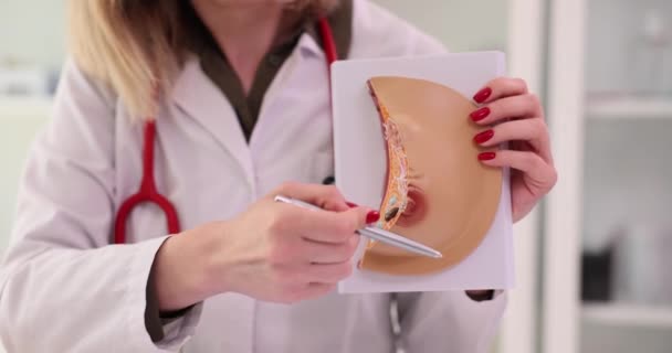 Emlőgyógyász Elmagyarázza Női Mell Betegségét Klinikán Plasztikai Sebészet Koncepció — Stock videók