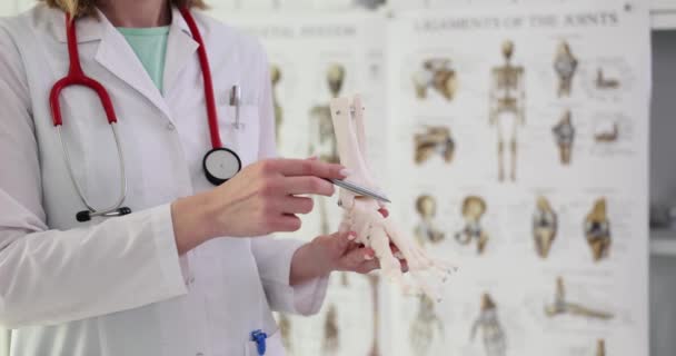 Médico Ortopédico Olha Para Tornozelo Esquelético Clínica Analisar Causas Degeneração — Vídeo de Stock