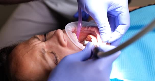 Close Van Tandarts Boren Van Een Patiënt Tanden Kliniek Behandeling — Stockvideo