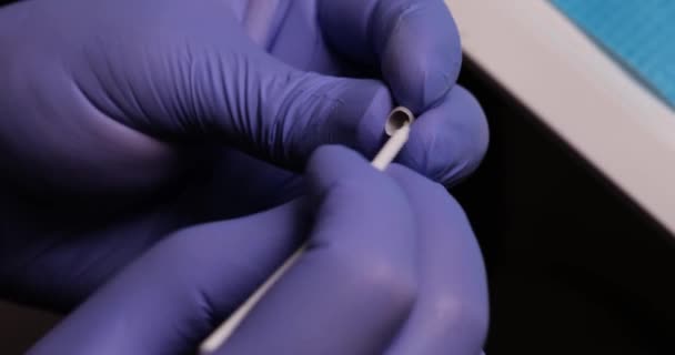 Dentysta Czyści Plastikową Okleinę Zębową Przygotowuje Się Montażu Usługi Stomatologiczne — Wideo stockowe